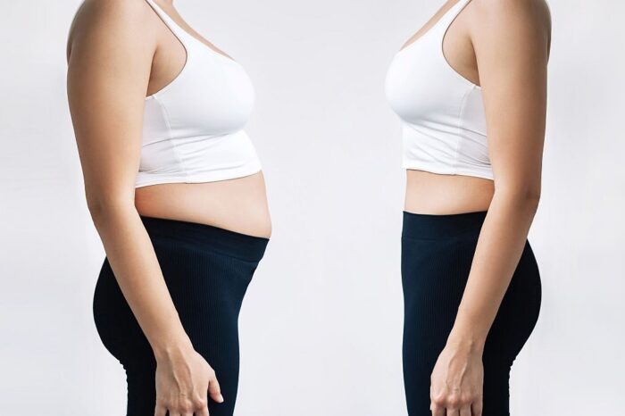 Woman in profile with a belly with excess fat and toned slim stomach before and after losing weight on gray background. Result of diet, liposuction, training. Getting rid of overweight. Comparison